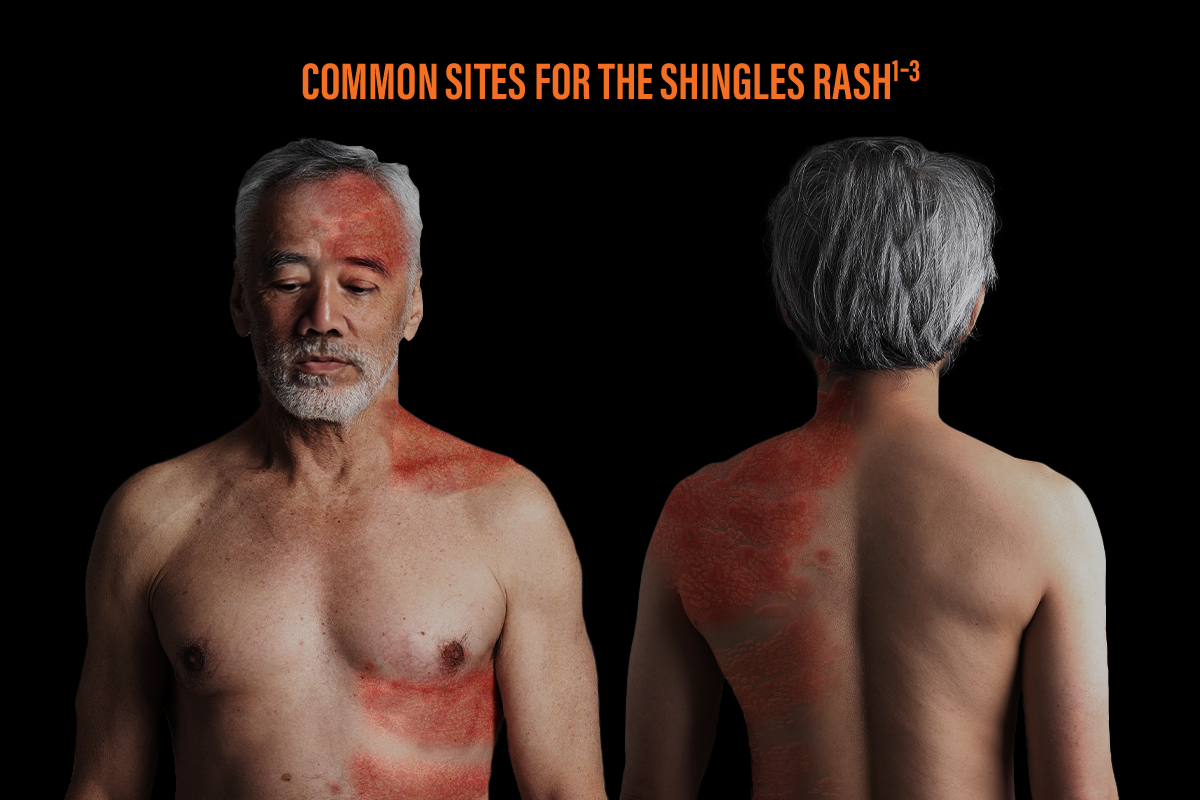 GSK Shingles Infographic 5_2025