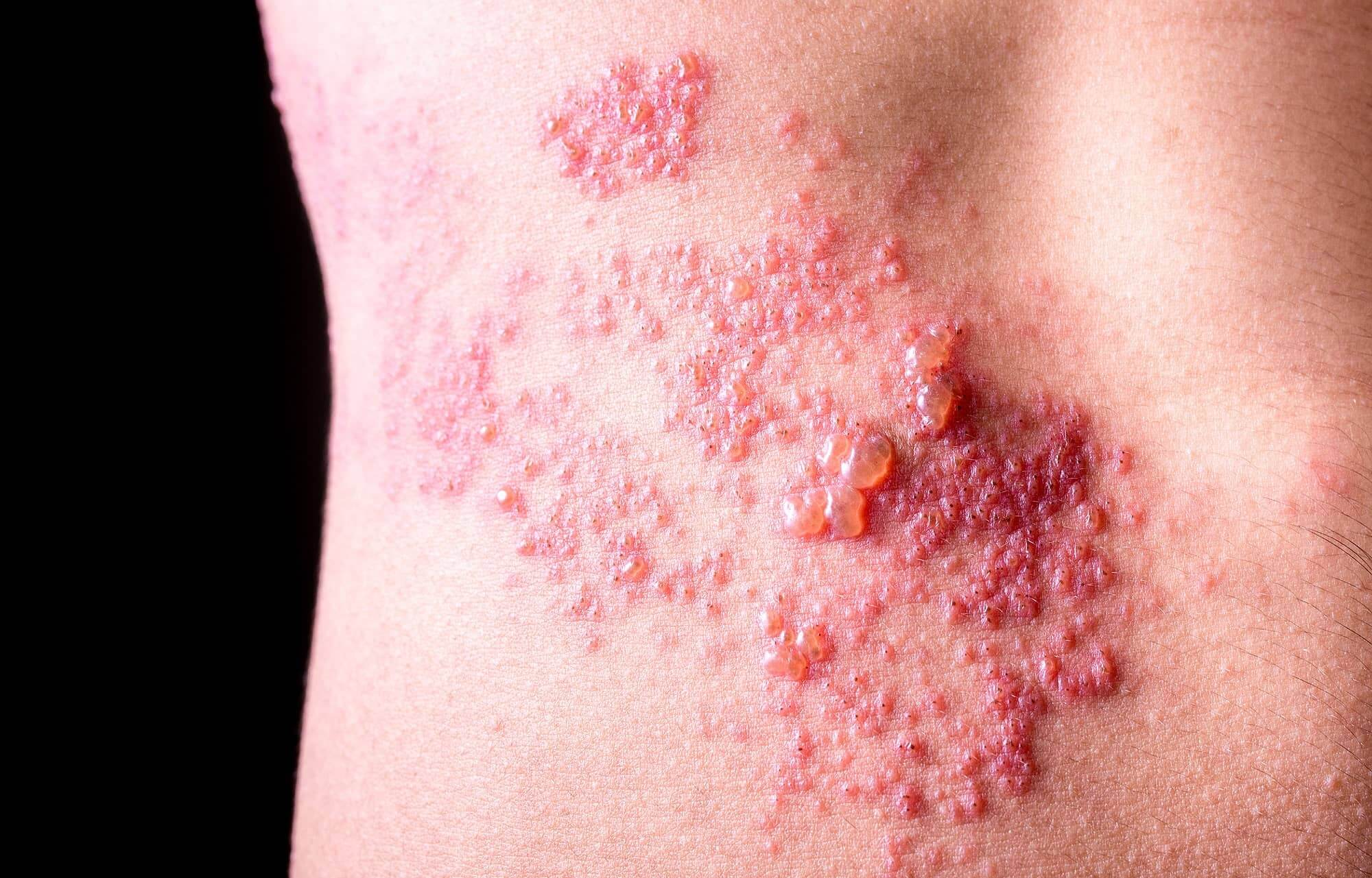 shutterstock_437265913-min